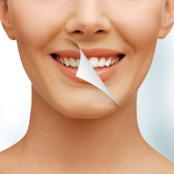 Full Cosmetic Smile Consultation