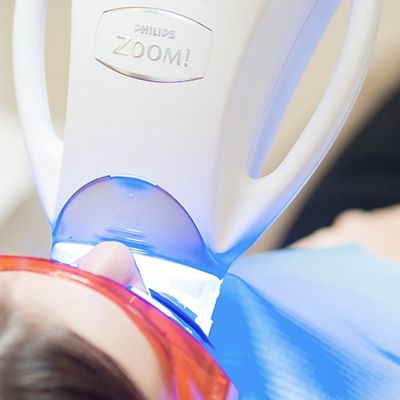 ZOOM Whitening (with light)