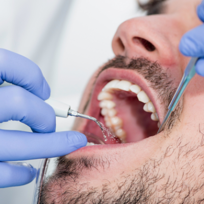 Dental implant Procedure