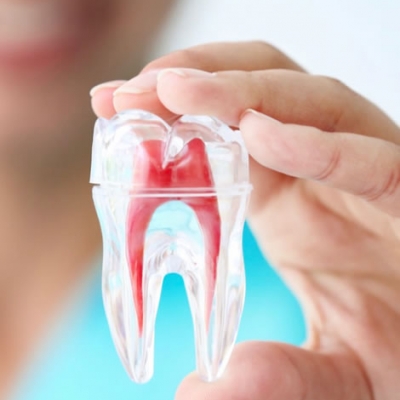 Root Canal Treatment