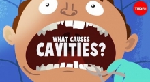 What Causes Cavities