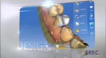 How Does CEREC Same Day Dentistry Works?