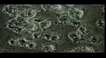 See plaque formation in real time- 2mins